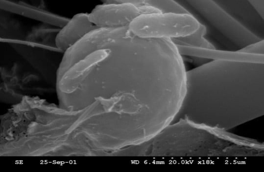 Figure 1. E. coli adhering to selected yeast fraction (Safmannan®)